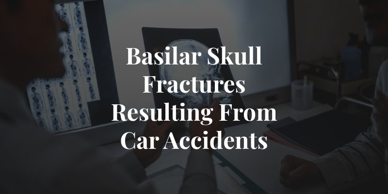 Basilar Skull Fracture and car accidents